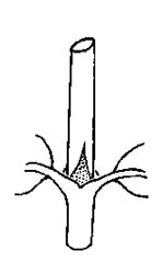 Stipules interpetiolar